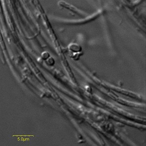 Differential interference contrast image of the cyanobacterial culture from whic