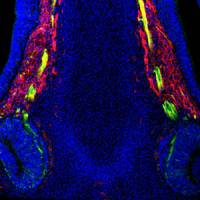 Crucial sex hormones re-routed by missing molecule