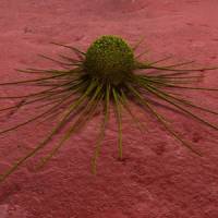 Genes 'decide who wins in body's battle against cancer'