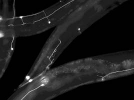 Microchip technology rapidly identifies compounds for regrowing nerves in live animals