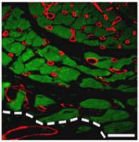 Potential role for vitamin B1 in preventing heart problems in people with diabetes