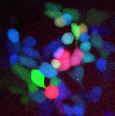 Cells glow brightly 18 hours after being infected with a genetically engineered 