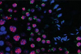 The various stages of sperm cell development.