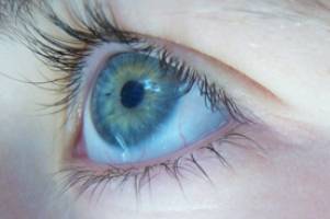 Blindness recovery in sight