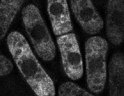 Cells sentenced to death. Cells are dying when zinc cannot bind to Dicer and the