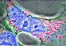 Human embryonic kidney cells were used to test the DNA cages