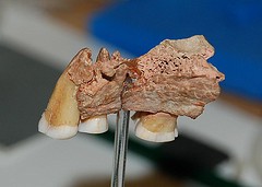 A photograph of the maxilla including three teeth, of the earliest known modern 