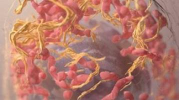 New insights in melanoma metastasis.