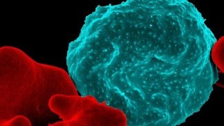 � 2011 par NIAID_Flickr