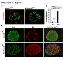 Researchers discover mechanism that could convert certain cells into insulin-making cells