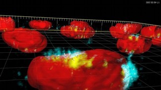 Superparamagnetic iron oxide particles (blue and yellow) absorbed in a nucleus o