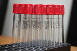 Test tube reveals new ageing cause