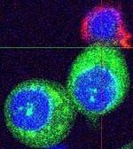 Image shows killer T-cells engaging and killing beta cells. The cells are staine