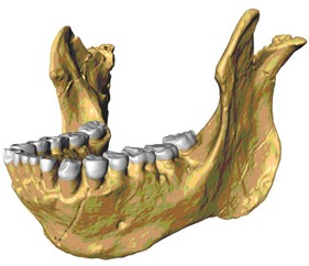 (Top)  Three-dimensional reconstruction of the new lower
jaw KNM-ER 60000, based