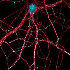 Amyloid beta (cyan blue) binds to nerve
cells of the hippocampus (red) and attac