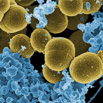 Staphylococcus aureus bacteria (yellow) escape destruction by human white blood 