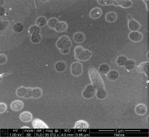 Tiny pores in graphene could give rise to membranes