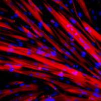 Transplant of patient-derived stem cells into mice with muscular dystrophy