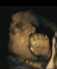 4-d scan of fetus at 32 weeks&rsquo; gestation