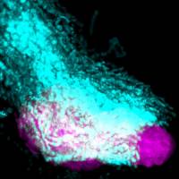 'Chase and run' cell movement mechanism explains metastasis
