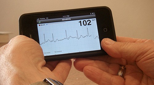 The iECG allows doctors to screen patients for atrial fibrillation, the most com
