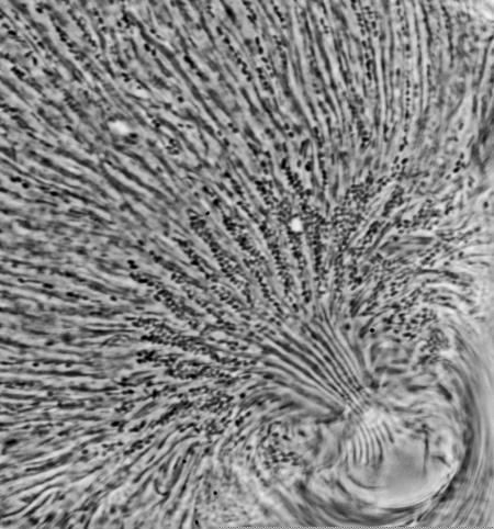 Phase contrast photomicrograph of a termite gut protozoan and attached symbiotic