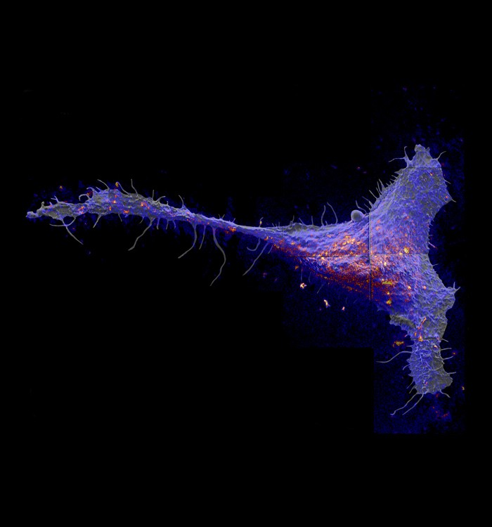 Researchers  found that a class of molecules called sphingolipds congregate in l