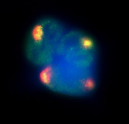 The Xist lncRNA (red) recruits proteins responsible for modifying chromatin arch