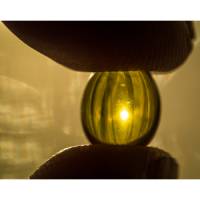 Obesity leads to vitamin D deficiency