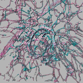 Three dimensional reconstruction of
blood vessels stained for the endothelial ce