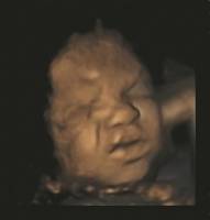 Unborn babies 'practise' facial expressions in the womb