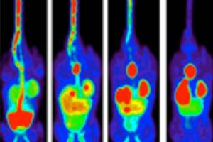 New method to analyse how cancer cells die