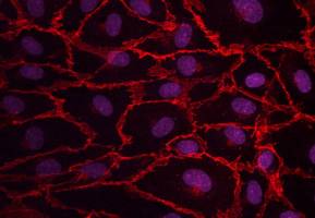 Smoking impairs blood vessel repair