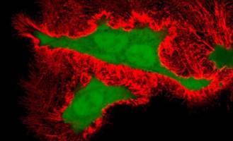 Heidelberg Researchers Investigate Cytotoxic Effect of Ebola Virus