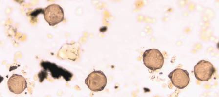 Hay fever's hidden supporting substances