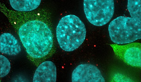 Human kidney cells stained with a P-body marker (red) and NoBody (green). Yellow