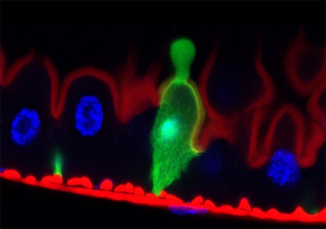 � Catherine Socha.  Drosophila epithelium. An enterocyte (green) dumps its damag