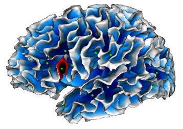 � SCALP team / INT  Mapping of cortical fold depths. In green: sulcal pits (the 