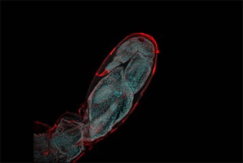 Leg regeneration in Parhyale hawaiensis . � Frederike Alwes