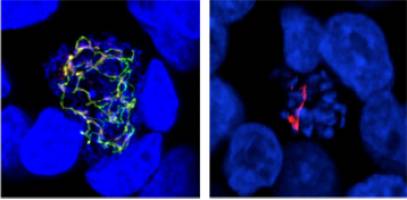 Malaria and toxoplasmosis have an Achilles heel from plants