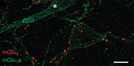 � Zussy et al., 2016  View of synapses in the amygdala of a mouse, obtained usin