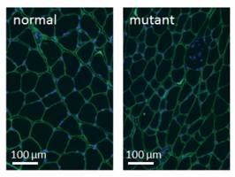 Placenta in females, muscle mass in males: the dual heritage of a virus