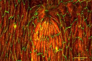 Scar-free wound healing