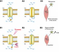 Spasticity: two potential therapeutic avenues
