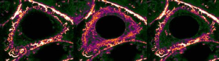 Stress leads to an internal reorganization of the body's cells