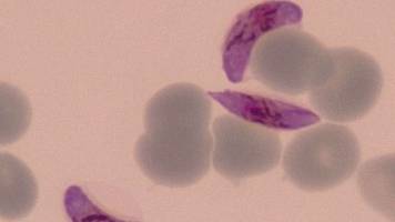 A milestone in the fight against malaria