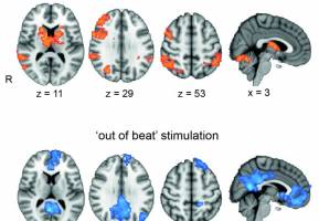 Buzzing the brain with electricity can boost working memory