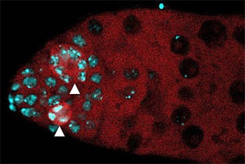 PLoS Genetics,  expand the possible mechanisms by which cell death could be targ