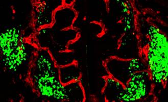Motor Neurons Tell Blood Vessels Where To Go