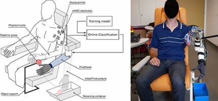 A prosthetic arm that decodes phantom limb movements